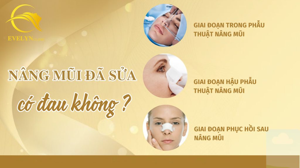Nâng mũi đã sửa có đau không? Chia sẻ kinh nghiệm nâng mũi lần 2 1