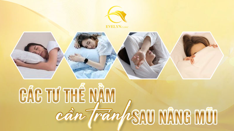 Nâng mũi bao lâu được nằm nghiêng? Tìm hiểu tư thế nằm chuẩn sau nâng mũi 3